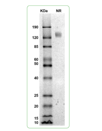 MW: Molecular Weight marker reduced condition
NR: IFNγR1 dimer under non-reduced condition